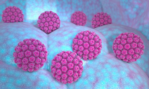 Understanding Abnormal Pap Smear and Human Papillomavirus (HPV)