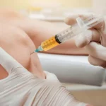 -Wrinkle Injections