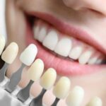 dental implant