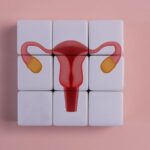 PCOS and Cortisol