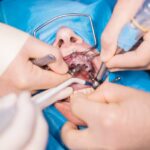 Oral Surgery Decisions